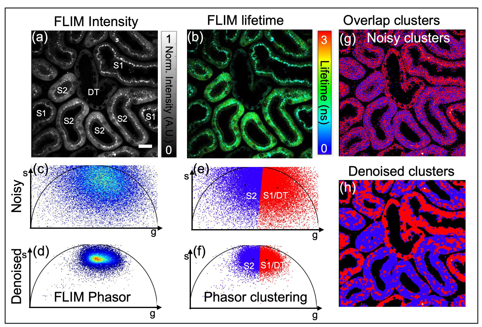 Improving fluorescence lifetime imaging microscopy phasor accuracy using convolutional neural networks